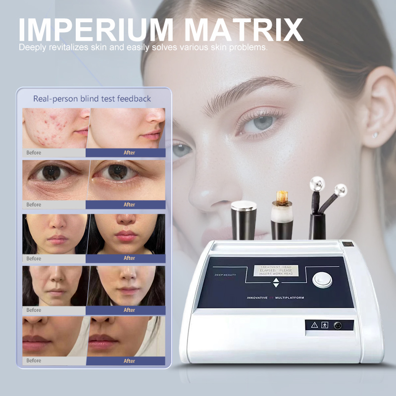 Imperium Matrix 3 In 1 RF Microneedle Machine, Fractional RF Endolift Mesowave Skin Rejuvenation Acne Scar Removal Beauty Machine for Salon - Image 8